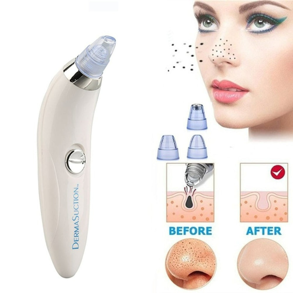 Blackhead Remover Vaccum Suction